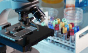 Setul de analize imunitate trebuie efectuat periodic la Synlab